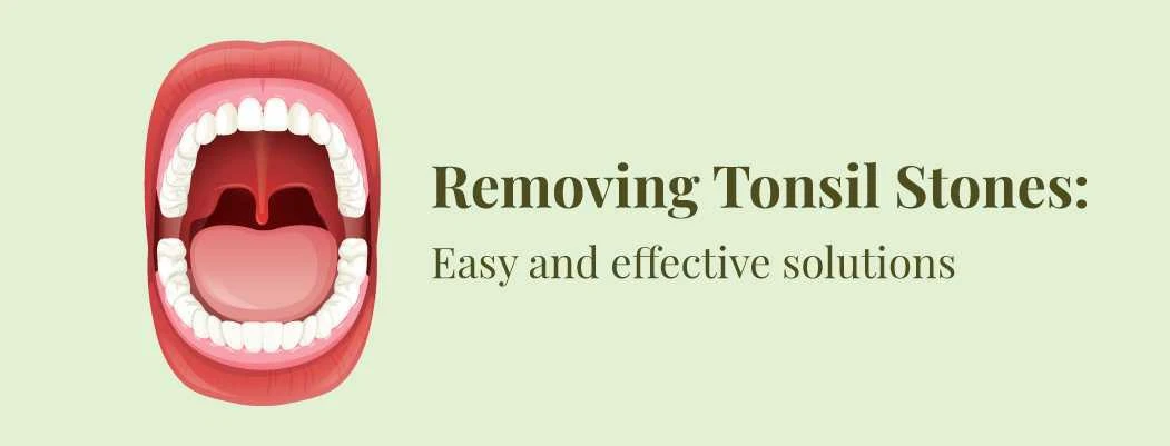 How To Remove Tonsil Stones